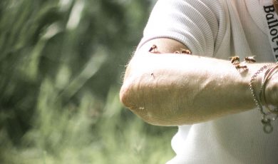 Soleil : Protéger votre peau avec l'apithérapie